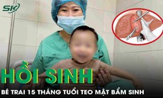 Bé trai 15 tháng tuổi thoát cửa tử nhờ ghép gan kịp thời
