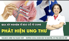 Xét nghiệm tế bào cổ tử cung có phát hiện ung thư không?