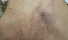 Vụ bạo hành trẻ ở Trường Mầm non Gia Thụy: 2 giáo viên bị tạm đình chỉ