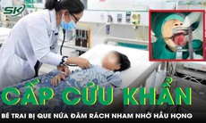 Bé trai 9 tuổi bị que nứa đâm sâu vào hầu họng chảy nhiều máu, vết thương rách nham nhở 
