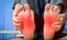 6 triệu chứng thiếu hụt vitamin E dễ bị bỏ qua và cách bổ sung