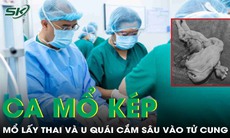 Mổ lấy thai cho sản phụ, bác sĩ phát hiện u quái cắm sâu vào eo tử cung