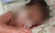 Trẻ sơ sinh nặng 0,7 kg bị hội chứng suy hô hấp cấp nặng được cứu sống ngoạn mục