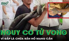 Đắp lá khi bị rắn hổ mang chúa cắn, người đàn ông ngừng tim, nguy cơ tử vong cao