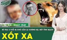 Bản tin Y tế 19/7: Bé trai 3 tuổi bị chó cắn lộ xương sọ, đứt tĩnh mạch