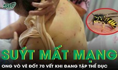 Ong vò vẽ đốt 70 vết khi đang tập thể dục, người phụ nữ suýt mất mạng 
