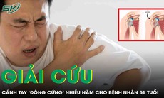 Giải cứu cánh tay 'đông cứng' suốt nhiều năm cho bệnh nhân 51 tuổi
