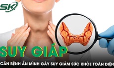 Suy giáp: Căn bệnh âm thầm gây suy giảm sức khoẻ toàn diện