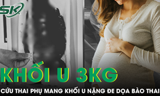 Cứu thai phụ mang khối u 3kg chèn ép toàn vùng chậu gây nguy hiểm đến bào thai