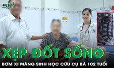 Cụ bà 102 tuổi ngã xẹp đốt sống được điều trị thành công nhờ bơm xi măng sinh học