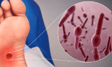 Chủ quan với vết thương nhỏ có thể mắc uốn ván nguy hiểm