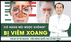 [LIVE] Bị viêm xoang có nâng mũi được không? 