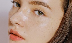 Trị nám bằng nguyên liệu tự nhiên có hiệu quả không?