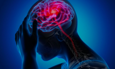 Đau nửa đầu cần làm gì để giảm nhanh cơn đau?