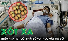 Thiếu niên 17 tuổi ở Hà Nội bị viêm não Nhật Bản, phải sống thực vật cả đời