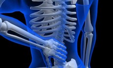 Viêm cột sống dính khớp có nguy hiểm không, những ai dễ mắc bệnh?