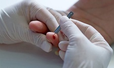 Có nên chích đầu ngón tay khi đột quỵ?