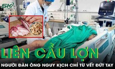 Chế biến tóp mỡ, người đàn ông bị nhiễm liên cầu lợn từ vết cắt nhỏ trên tay