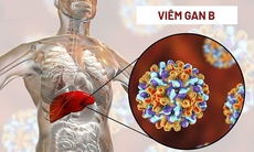 Biểu hiện của viêm gan B giai đoạn đầu