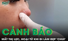 Biến chứng filler: Mất thị lực, hoại tử vì làm đẹp “chui”