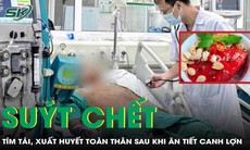 Nam thanh niên 30 tuổi suýt chết sau khi ăn tiết canh lợn
