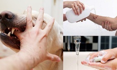 Dấu hiệu và triệu chứng của bệnh dại
