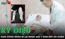 Một năm sau tai nạn đứt lìa chân, nam công nhân đã đi lại trên chính đôi chân của mình