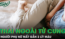 Phú Thọ: Cứu sống sản phụ vỡ thai ngoài tử cung, mất gần 2 lít máu