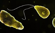 Australia phát hiện 'amip ăn não' trong nguồn nước sinh hoạt