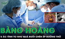 Bàng hoàng phát hiện u ác tính gần 11 cm, to như quả bưởi chèn ép đường thở 