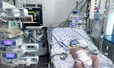 Sốt xuất huyết ở TPHCM tăng mạnh, nhiều trẻ nguy kịch do biến chứng nặng