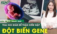Bản Tin Y Tế 26/8: Thai nhi 28 tuần đa ối, giãn bể thận do đột biến gene