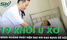 Đau bụng dữ dội đi khám bàng hoàng phát hiện có 19 khối u xơ tử cung hiếm gặp 