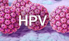 Nhiễm virus HPV có triệu chứng không?