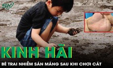 Kinh hãi phát hiện nguyên nhân những đường ngoằn ngoèo trên lòng bàn tay bé trai 4 tuổi