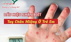 Bệnh tay chân miệng ở trẻ và cách hỗ trợ chăm sóc từ thảo dược tự nhiên