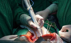 Người đàn ông mắc ung thư gan hồi sinh nhờ công nghệ hiện đại lần đầu đầu thực hiện ở Đồng bằng sông Cửu Long