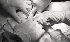 Dùng thuốc nam chữa u nang buồng trứng, người phụ nữ mang khối u nặng 9kg suốt 3 năm