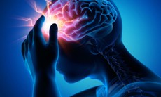 Dị dạng mạch máu não có nguy hiểm không?