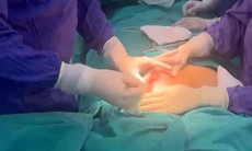 Sau tiêm nâng ngực 5 năm, nữ bệnh nhân bị biến chứng nặng