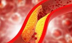 6 loại đồ uống khi bụng đói giúp giảm cholesterol xấu
