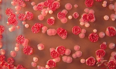 Cảnh báo nguy cơ nhiễm khuẩn huyết do bệnh Whitmore