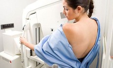 Sự khác biệt giữa chụp nhũ ảnh sàng lọc và chụp nhũ ảnh chẩn đoán ung thư vú
