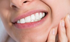 Bệnh nhân đau đầu suốt 30 năm vì răng mọc lạc chỗ trong xoang trán