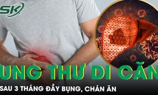 Bất ngờ phát hiện ung thư dạ dày di căn sau 3 tháng đầy bụng, chán ăn