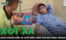 Xót xa: Nam thanh niên 25 tuổi mắc ung thư đại trực tràng vì thói quen phổ biến ở giới trẻ