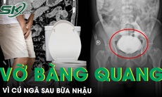 Vỡ bàng quang  sau cú ngã, hạ vị đau dữ dội và bí tiểu suốt 4 giờ