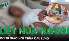 Liệt nửa người vì tự giác hơi chữa đau lưng