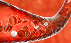 6 thực phẩm giúp ‘dọn sạch’ động mạch, giảm nguy cơ đột quỵ và đau tim