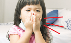 Ho kéo dài ở trẻ: Nguyên nhân thường gặp và cách xử trí hiệu quả